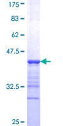 Novus Biologicals Recombinant Human MAML2 GST (N-Term) Protein 10 &mu;g | Buy Online | Novus Biologicals&trade; | Fisher Scientific