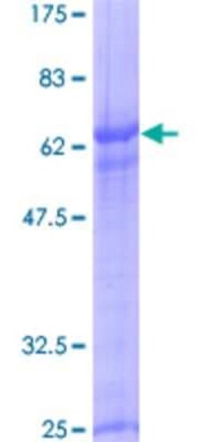 Novus Biologicals Recombinant Human RHOXF2 GST (N-Term) Protein 2 &mu;g | Buy Online | Novus Biologicals&trade; | Fisher Scientific