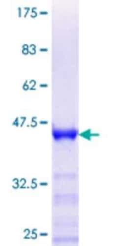 Novus Biologicals Recombinant Human RHOXF2 GST (N-Term) Protein 10 &mu;g | Buy Online | Novus Biologicals&trade; | Fisher Scientific