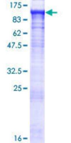Novus Biologicals Recombinant Human PGBD1 GST (N-Term) Protein 25 &mu;g | Buy Online | Novus Biologicals&trade; | Fisher Scientific