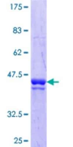 Novus Biologicals Recombinant Human PGBD1 GST (N-Term) Protein 10 &mu;g | Buy Online | Novus Biologicals&trade; | Fisher Scientific