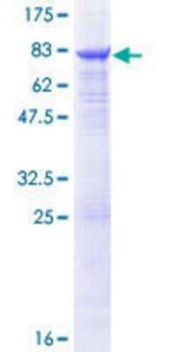 Novus Biologicals Recombinant Human TUBB6 GST (N-Term) Protein 10 &mu;g | Buy Online | Novus Biologicals&trade; | Fisher Scientific