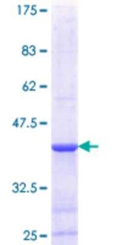 Novus Biologicals Recombinant Human DGAT2 GST (N-Term) Protein 10 &mu;g | Buy Online | Novus Biologicals&trade; | Fisher Scientific