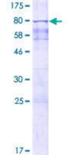 Novus Biologicals Recombinant Human SPZ1 GST (N-Term) Protein 10 &mu;g | Buy Online | Novus Biologicals&trade; | Fisher Scientific