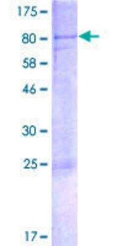 Novus Biologicals Recombinant Human GliS2 GST (N-Term) Protein 2 &mu;g | Buy Online | Novus Biologicals&trade; | Fisher Scientific
