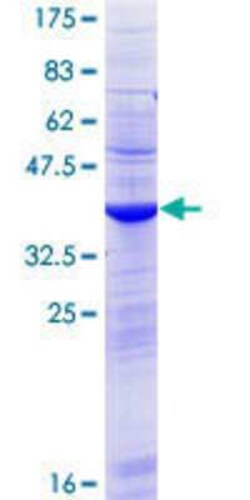 Novus Biologicals Recombinant Human TXLNGY GST (N-Term) Protein 25 &mu;g | Buy Online | Novus Biologicals&trade; | Fisher Scientific
