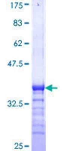 Novus Biologicals Recombinant Human TXLNGY GST (N-Term) Protein 25 &mu;g | Buy Online | Novus Biologicals&trade; | Fisher Scientific