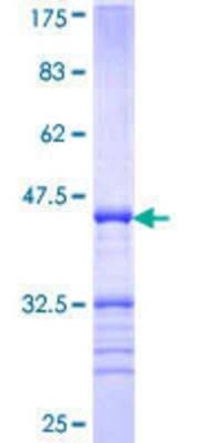 Novus Biologicals Recombinant Human MYPN GST (N-Term) Protein 25 &mu;g | Buy Online | Novus Biologicals&trade; | Fisher Scientific