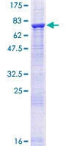 Novus Biologicals Recombinant Human PHACS GST (N-Term) Protein 10 &mu;g | Buy Online | Novus Biologicals&trade; | Fisher Scientific