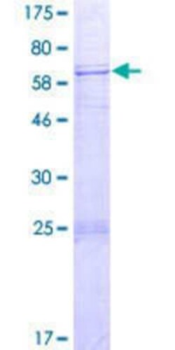 Novus Biologicals Recombinant Human SPATA22 GST (N-Term) Protein 2 &mu;g | Buy Online | Novus Biologicals&trade; | Fisher Scientific