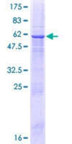 Novus Biologicals&trade;&nbsp;Recombinant Human CAPS2 GST (N-Term) Protein