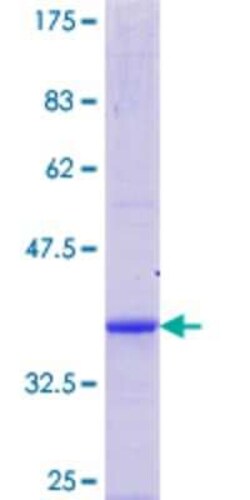 Novus Biologicals Recombinant Human CAPS2 GST (N-Term) Protein 25 &mu;g | Buy Online | Novus Biologicals&trade; | Fisher Scientific