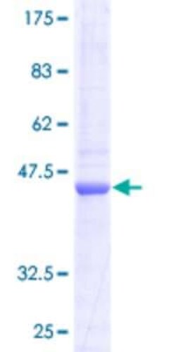 Novus Biologicals Recombinant Human COX IV Isoform 2 GST (N-Term) Protein 10 &mu;g | Buy Online | Novus Biologicals&trade; | Fisher Scientific