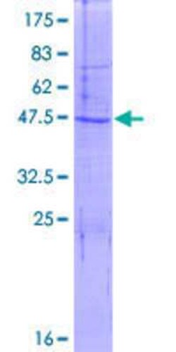 Novus Biologicals Recombinant Human COX IV Isoform 2 GST (N-Term) Protein 10 &mu;g | Buy Online | Novus Biologicals&trade; | Fisher Scientific