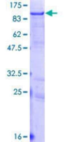 Novus Biologicals Recombinant Human Lnx1 GST (N-Term) Protein 10 &mu;g | Buy Online | Novus Biologicals&trade; | Fisher Scientific