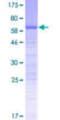 Novus Biologicals Recombinant Human PSRC1 GST (N-Term) Protein 25 &mu;g | Buy Online | Novus Biologicals&trade; | Fisher Scientific