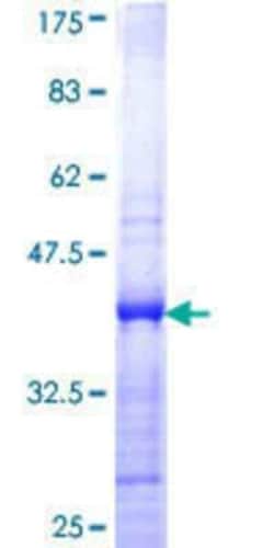 Novus Biologicals Recombinant Human Cbx2 GST (N-Term) Protein 25 &mu;g | Buy Online | Novus Biologicals&trade; | Fisher Scientific