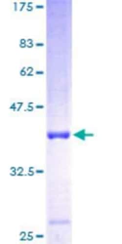 Novus Biologicals Recombinant Human FUT10 GST (N-Term) Protein 25 &mu;g | Buy Online | Novus Biologicals&trade; | Fisher Scientific