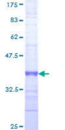Novus Biologicals Recombinant Human PCGF1 GST (N-Term) Protein 10 &mu;g | Buy Online | Novus Biologicals&trade; | Fisher Scientific