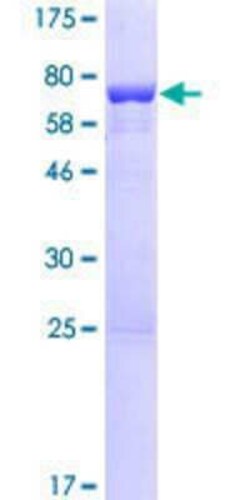 Novus Biologicals Recombinant Human EFCAB4B GST (N-Term) Protein 25 &mu;g | Buy Online | Novus Biologicals&trade; | Fisher Scientific