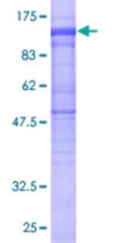 Novus Biologicals Recombinant Human PLCD4 GST (N-Term) Protein 25 &mu;g | Buy Online | Novus Biologicals&trade; | Fisher Scientific