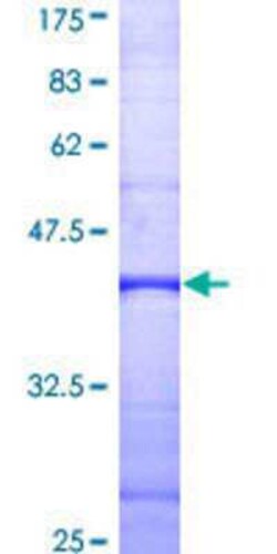 Novus Biologicals&trade;&nbsp;Recombinant Human PLCD4 GST (N-Term) Protein