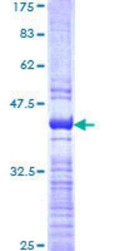 Novus Biologicals Recombinant Human ZNF496 GST (N-Term) Protein 25 &mu;g | Buy Online | Novus Biologicals&trade; | Fisher Scientific