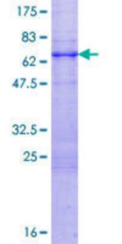 Novus Biologicals Recombinant Human TRIM52 GST (N-Term) Protein 25 &mu;g | Buy Online | Novus Biologicals&trade; | Fisher Scientific
