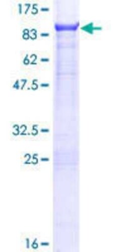 Novus Biologicals Recombinant Human STEP GST (N-Term) Protein 10 &mu;g | Buy Online | Novus Biologicals&trade; | Fisher Scientific