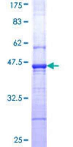 Novus Biologicals Recombinant Human STEP GST (N-Term) Protein 10 &mu;g | Buy Online | Novus Biologicals&trade; | Fisher Scientific