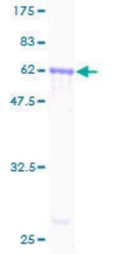 Novus Biologicals Recombinant Human AMID GST (N-Term) Protein 25 &mu;g | Buy Online | Novus Biologicals&trade; | Fisher Scientific