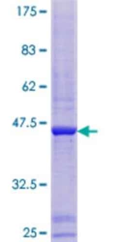 Novus Biologicals Recombinant Human ATAD1 GST (N-Term) Protein 10 &mu;g | Buy Online | Novus Biologicals&trade; | Fisher Scientific