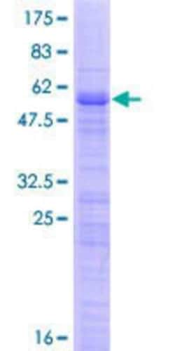 Novus Biologicals Recombinant Human TBRG1 GST (N-Term) Protein 25 &mu;g | Buy Online | Novus Biologicals&trade; | Fisher Scientific