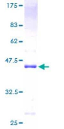 Novus Biologicals Recombinant Human NFATC2IP GST (N-Term) Protein 10 &mu;g | Buy Online | Novus Biologicals&trade; | Fisher Scientific