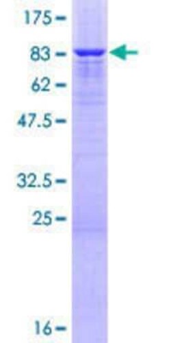 Novus Biologicals Recombinant Human LRP-11 GST (N-Term) Protein 25 &mu;g | Buy Online | Novus Biologicals&trade; | Fisher Scientific