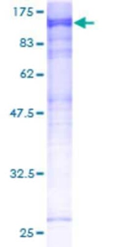 Novus Biologicals&trade;&nbsp;Recombinant Human MASTL GST (N-Term) Protein