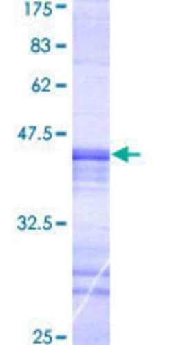 Novus Biologicals Recombinant Human MASTL GST (N-Term) Protein 25 &mu;g | Buy Online | Novus Biologicals&trade; | Fisher Scientific