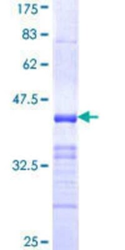 Novus Biologicals Recombinant Human ZNRF1 GST (N-Term) Protein 10 &mu;g | Buy Online | Novus Biologicals&trade; | Fisher Scientific