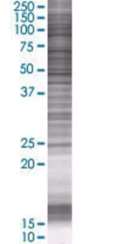 Novus Biologicals&trade;&nbsp;ZNRF1 293T Cell Transient Overexpression Lysate