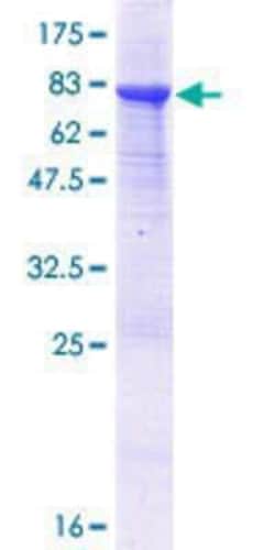 Novus Biologicals Recombinant Human ATG4C GST (N-Term) Protein 25 &mu;g | Buy Online | Novus Biologicals&trade; | Fisher Scientific