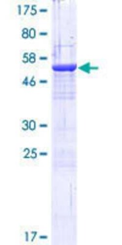 Novus Biologicals Recombinant Human CORO6 GST (N-Term) Protein 25 &mu;g | Buy Online | Novus Biologicals&trade; | Fisher Scientific