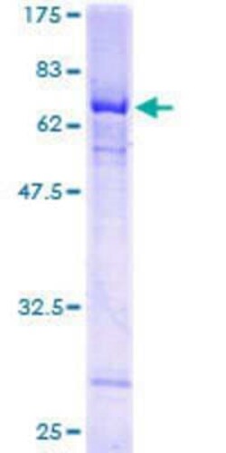 Novus Biologicals Recombinant Human HSH2D GST (N-Term) Protein 10 &mu;g | Buy Online | Novus Biologicals&trade; | Fisher Scientific