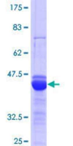Novus Biologicals Recombinant Human HSH2D GST (N-Term) Protein 25 &mu;g | Buy Online | Novus Biologicals&trade; | Fisher Scientific