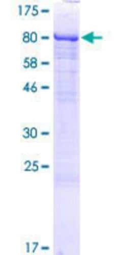 Novus Biologicals&trade;&nbsp;Recombinant Human LTV1 GST (N-Term) Protein
