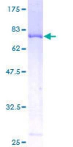Novus Biologicals Recombinant Human Tensin 4/CTEN GST (N-Term) Protein 25 &mu;g | Buy Online | Novus Biologicals&trade; | Fisher Scientific