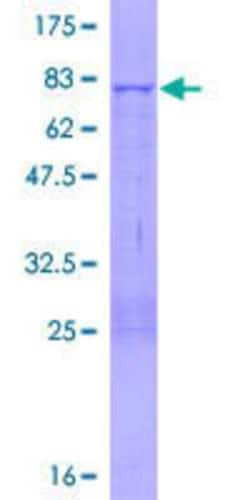 Novus Biologicals Recombinant Human MPND GST (N-Term) Protein 10 &mu;g | Buy Online | Novus Biologicals&trade; | Fisher Scientific