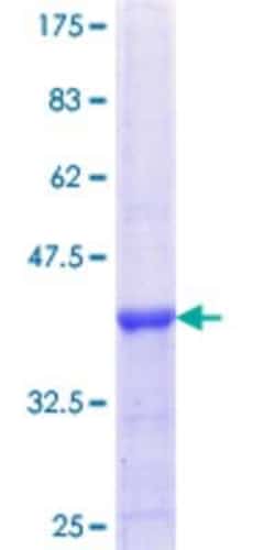 Novus Biologicals Recombinant Human UBASH3B/STS1/Tula-2 GST (N-Term) Protein 25 &mu;g | Buy Online | Novus Biologicals&trade; | Fisher Scientific