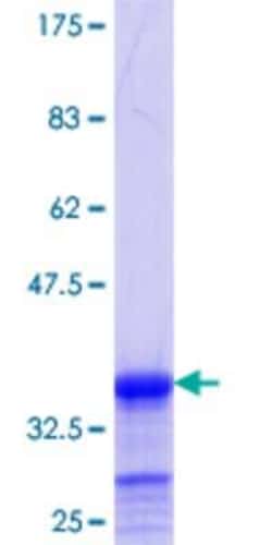 Novus Biologicals Recombinant Human Ajuba GST (N-Term) Protein 10 &mu;g | Buy Online | Novus Biologicals&trade; | Fisher Scientific