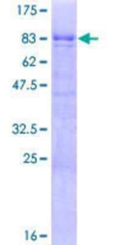 Novus Biologicals Recombinant Human TOX2 GST (N-Term) Protein 10 &mu;g | Buy Online | Novus Biologicals&trade; | Fisher Scientific