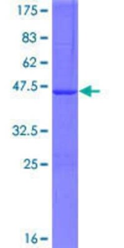 Novus Biologicals Recombinant Human ATG4D GST (N-Term) Protein 25 &mu;g | Buy Online | Novus Biologicals&trade; | Fisher Scientific